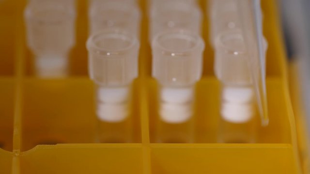 Close-up of laboratory equipment for microbiological research, specialist taking nozzle on pipette out from plastic box while working in scientific laboratory