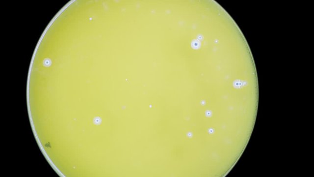 growing fungi in petri dishes time lapse