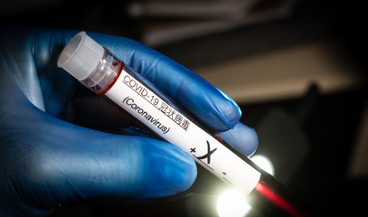 Coronavirus Positive Blood Sample