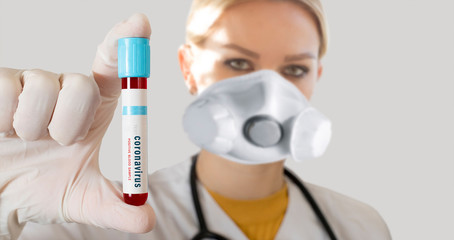doctor holding a positive coronavirus blood sample, blood tube
