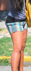 Obraz na płótnie Canvas Female with cellulite legs.