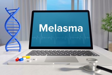 Melasma – Medizin, Gesundheit. Computer im Büro mit Begriff auf dem Bildschirm. Arzt, Gesundheitswesen