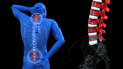 Anatomical vision back pain. Spine anatomy. 3D illustration.