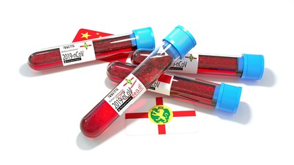 Alderney national flag 3D wuhan 2019-ncov virus bio test tube. 3D illustration