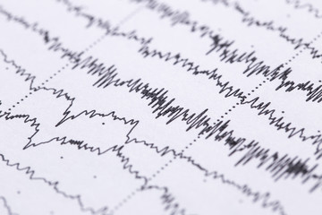 Cardiogram on a sheet of paper close-up. Texture of pulsed waves.