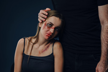 Strong man put his hand on female head, like hugging. Scared victim with bruises on face sitting nearby. Blue background. Domestic violence. Close-up
