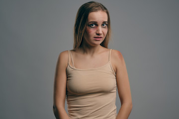 Naklejka premium Blonde girl with bruises on her face posing against gray studio background. Domestic violence, abuse. Depression, despair. Close-up, copy space.