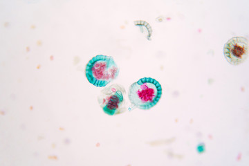 Botanical study of fern spore under microscopic view.