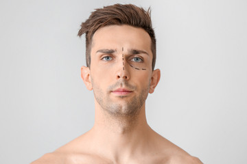 Naklejka premium Young man with marks on his face against light background. Concept of plastic surgery
