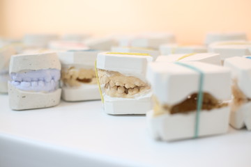 teeth mold, Teeth cast models. Several cast models of the teeth standing on the table with tools in working place in the office of a professional dentist.