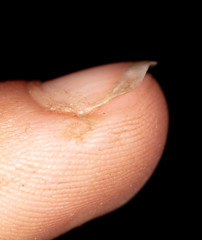 Nails with dirt on the finger