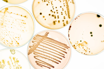 Growing Bacteria in Petri Dishes on agar gel Scientific experiment. - obrazy, fototapety, plakaty
