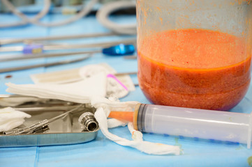 Bottle of liquid fat from liposuction. Slimming through plastic surgery. The figure of a dream.