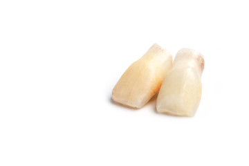 Baby teeth on a white background. Loss of two lower teeth of the child at the stage of formation of the jaw.