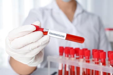 Scientist holding test tube with blood sample and label CORONA VIRUS in laboratory, closeup