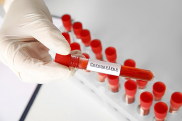 Scientist holding test tube with blood sample and label CORONA VIRUS in laboratory, above view