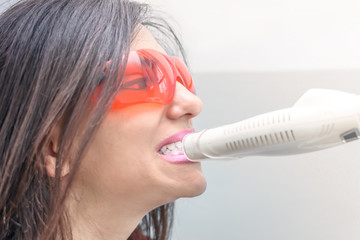 Close-up portrait of a female patient at dentist in the clinic. Teeth whitening procedure with...