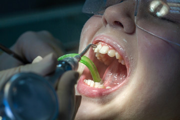 A child at the dentist's appointment. Dental treatment and brushing in the doctor’s office....
