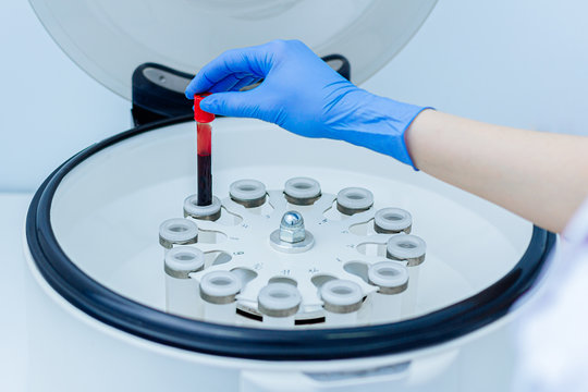 Laboratory assistant works with a centrifuge