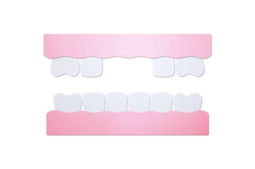 model tooth of missing teeth - dental cartoon paper cut style
