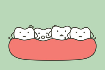 crowding teeth (malocclusion), dental problem - tooth cartoon vector flat style
