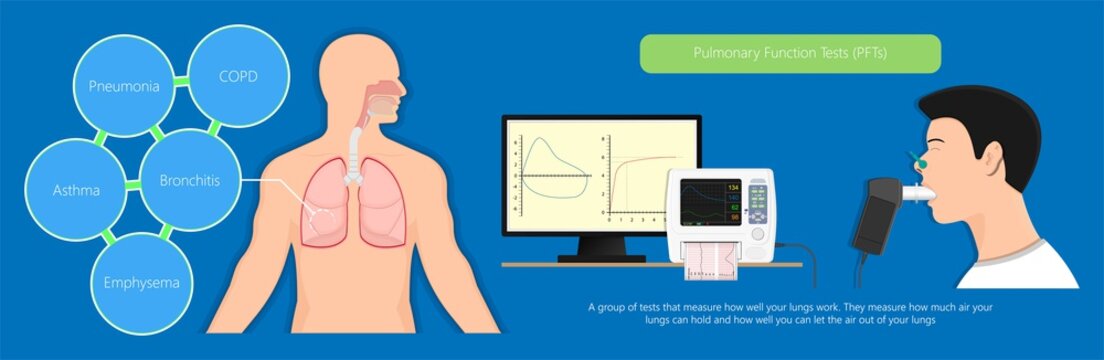 Pulmonary Lung Medical Pulmonary Function Test Measure Diagnostic Treat Cardiopulmonary Total Capacity TLC Bullous Emphysema PFT Asbestos Fibers