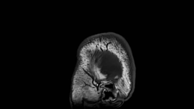 A brain MRI scan 3Tesla sag T1
