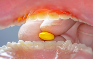 Man taking pills for depression. Old man swallowing pill