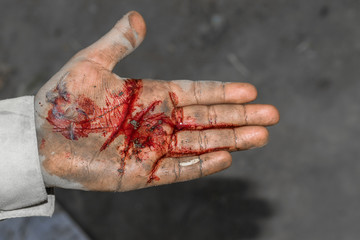 a young boy hand is cut off with a knife and the hand is bleeding
