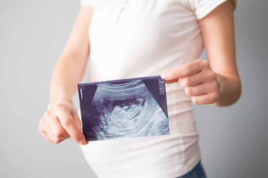 Pregnant woman holding ultrasound