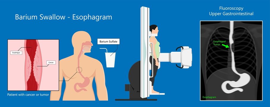 Intravenous pyelogram IVP exam diagnose treat ionizing symptom