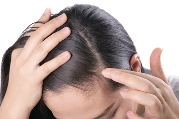 Young Asian women worry about problem hair loss,head bald,dandruff.hair loss problem and Hair treatment concept