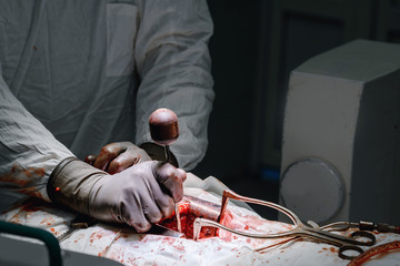 Surgery on chest, cardiac replacement, cardiology, surgeon sets clamp and stretch for ribs