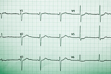 Electrocardiograph close up
