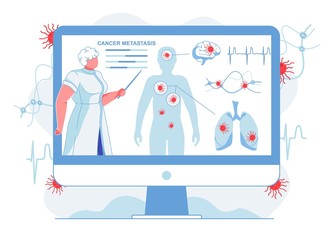 Doctor Showing Cancer Metastasis Flat Illustration