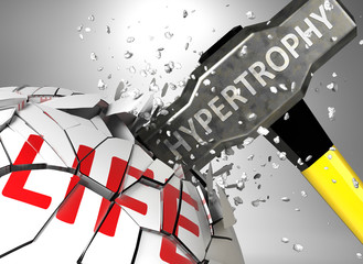 Hypertrophy and destruction of health and life - symbolized by word Hypertrophy and a hammer to show negative aspect of Hypertrophy, 3d illustration