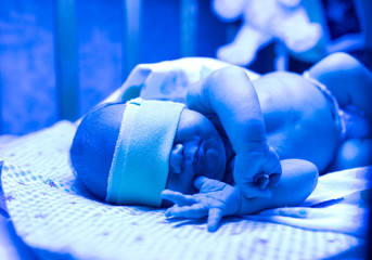 Newborn having a treatment for jaundice under ultraviolet light, Baby has high level of bilirubin, laying under blue light to reduce jaundice level. Safe medical procedures
