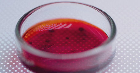  Petri Dishes with Bacteria, Tissue and Blood Samples. Medical Research Laboratory Curing Epidemic...
