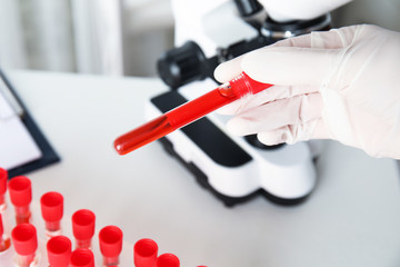 Scientist holding test tube with blood sample in laboratory, closeup. Virus research