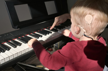A Boy With A Hearing Aids And Cochlear Implants Playing - 325763810