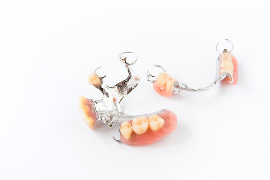 removable partial denture on white background.