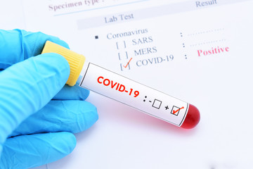 Obraz premium Blood sample tube positive with COVID-19 or novel coronavirus 2019 found in Wuhan, China
