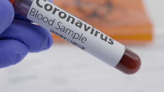 Microbiologist hand with blue surgical gloves showing a blood test tube for the new rapidly spreading Coronavirus. Blood test request form and biohazard transportation back in the background