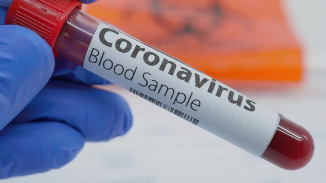 Microbiologist hand with blue surgical gloves showing a blood test tube for the new rapidly spreading Coronavirus. Blood test request form and biohazard transportation back in the background