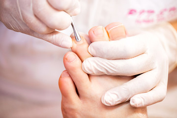 Cuticle treatment for pretty and clean toenails, men’s pedicure toenail concept - obrazy, fototapety, plakaty
