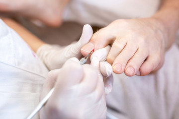 Dealing with feet nail edges