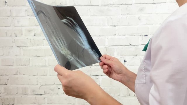 Traumatologist looks at the hands x-ray of a patient