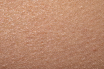 Goose bumps macro caused by cold. Hair erection reaction