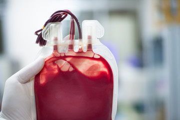 Close up red blood bag in laboratory.