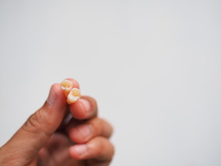 Woman's hand holding tooth after surgery removal of a tooth and white wooden background, The most common reason comes from not brushing teeth and eating sweets, Selective focus,
